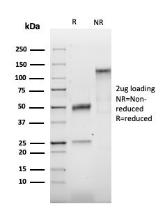 TIMP2 (Tissue Inhibitor of Metalloproteinase 2) Antibody in SDS-PAGE (SDS-PAGE)