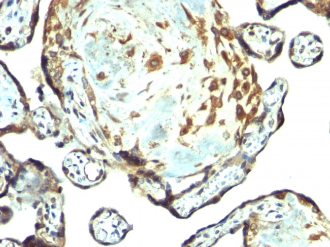 TIMP-3 (Tissue Inhibitor of Metalloproteinase-3) Antibody in Immunohistochemistry (Paraffin) (IHC (P))