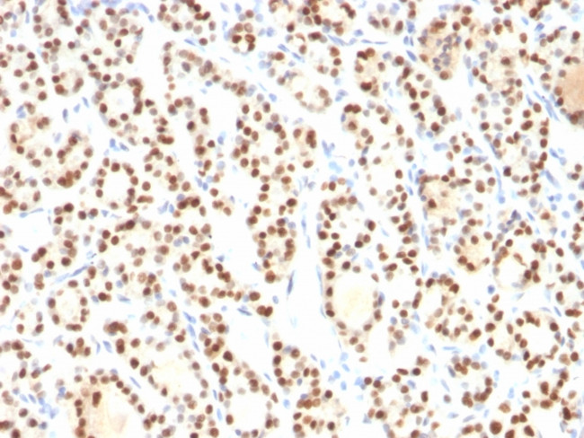 TTF-1/NKX2.1 (Thyroid and Lung Epithelial Marker) Antibody in Immunohistochemistry (Paraffin) (IHC (P))