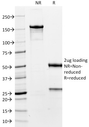 TTF-1/NKX2.1 (Thyroid and Lung Epithelial Marker) Antibody in SDS-PAGE (SDS-PAGE)