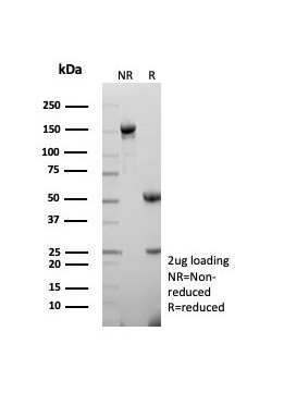 TTF-1/NKX2.1 (Thyroid and Lung Epithelial Marker) Antibody in SDS-PAGE (SDS-PAGE)