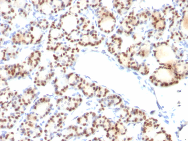 TTF-1/NKX2.1 (Thyroid and Lung Epithelial Marker) Antibody in Immunohistochemistry (Paraffin) (IHC (P))