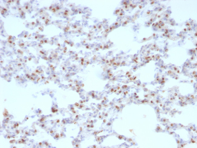 TTF-1/NKX2.1 (Thyroid and Lung Epithelial Marker) Antibody in Immunohistochemistry (Paraffin) (IHC (P))