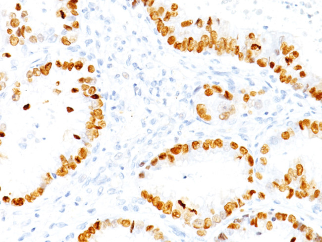 TTF-1/NKX2.1 (Thyroid and Lung Epithelial Marker) Antibody in Immunohistochemistry (Paraffin) (IHC (P))