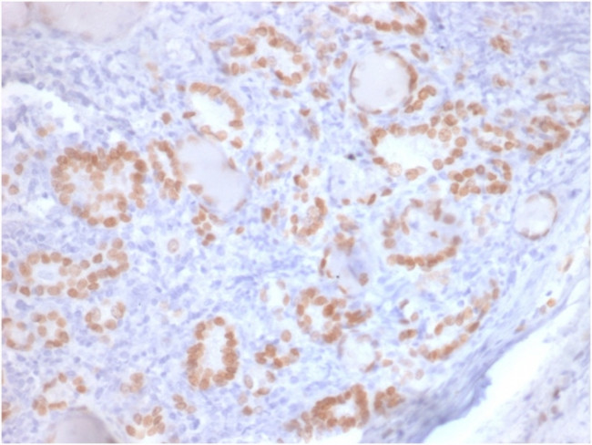 TTF-1/NKX2.1 Antibody in Immunohistochemistry (Paraffin) (IHC (P))