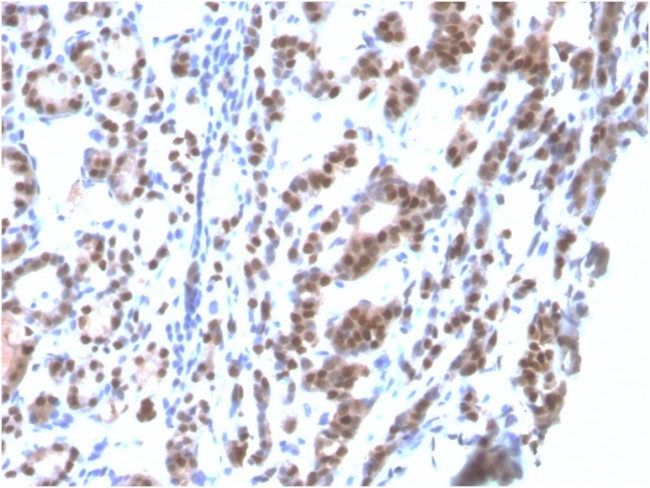 TTF-1/NKX2.1 Antibody in Immunohistochemistry (Paraffin) (IHC (P))