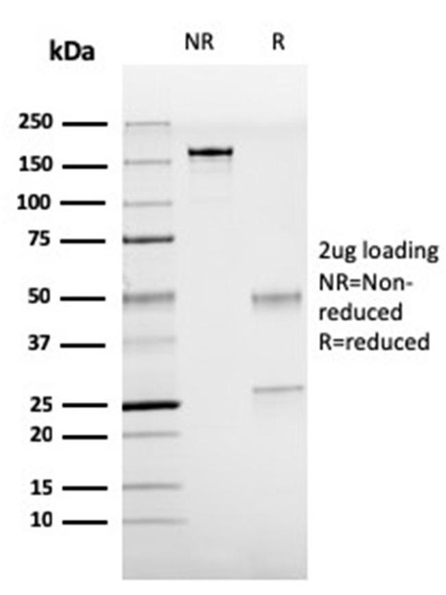 TTF-1/NKX2.1 Antibody in SDS-PAGE (SDS-PAGE)