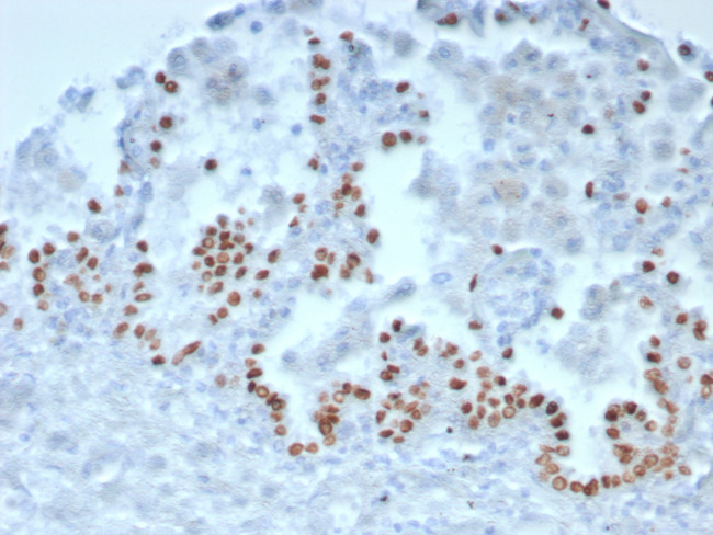 TTF-1/NKX2.1 (Thyroid and Lung Epithelial Marker) Antibody in Immunohistochemistry (Paraffin) (IHC (P))