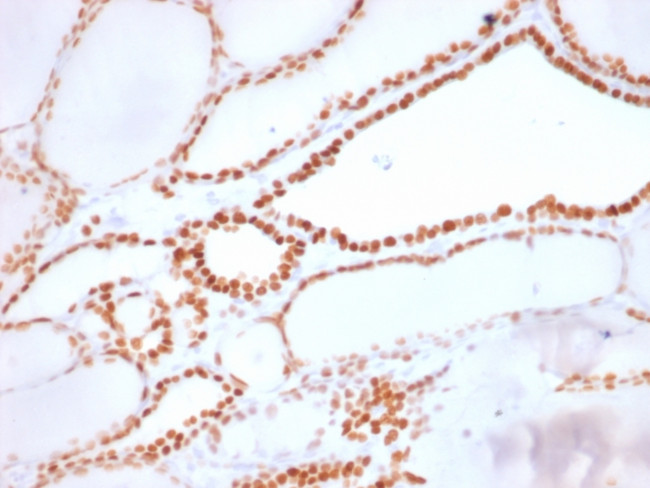 TTF-1/NKX2.1 Antibody in Immunohistochemistry (Paraffin) (IHC (P))