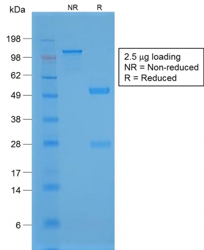 TTF-1/NKX2.1 Antibody in SDS-PAGE (SDS-PAGE)