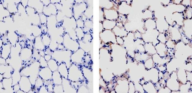 CCL5 (RANTES) Antibody in Immunohistochemistry (Paraffin) (IHC (P))