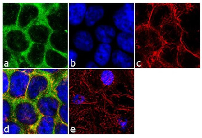 CCL5 (RANTES) Antibody in Immunocytochemistry (ICC/IF)