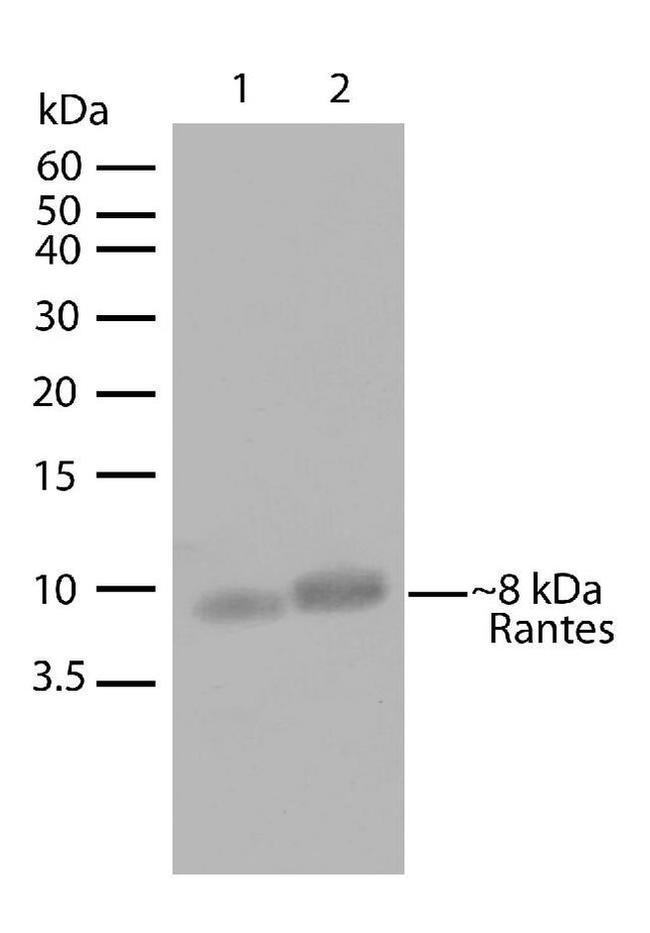 CCL5 (RANTES) Antibody in Western Blot (WB)