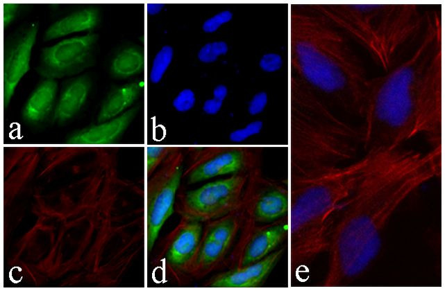 AKT1 Antibody in Immunocytochemistry (ICC/IF)