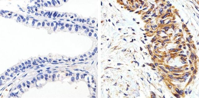 AKT1 Antibody in Immunohistochemistry (Paraffin) (IHC (P))