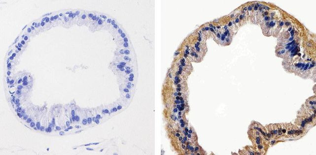 AKT1 Antibody in Immunohistochemistry (Paraffin) (IHC (P))