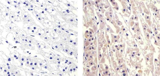 CXCL5 Antibody in Immunohistochemistry (Paraffin) (IHC (P))