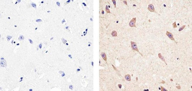 CXCL5 Antibody in Immunohistochemistry (Paraffin) (IHC (P))