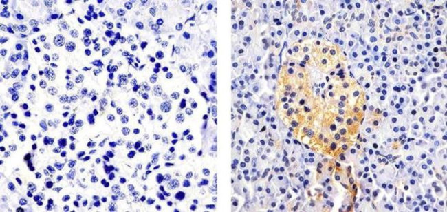 CXCL5 Antibody in Immunohistochemistry (Paraffin) (IHC (P))