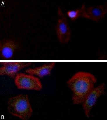 LC3B Antibody in Immunocytochemistry (ICC/IF)