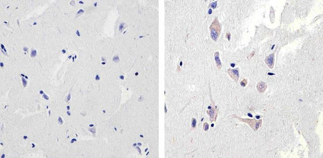 NMDAR1 Antibody in Immunohistochemistry (Paraffin) (IHC (P))