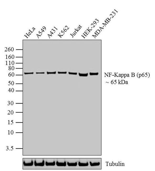 NFkB p65 Antibody in Western Blot (WB)