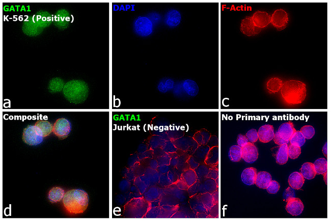 GATA1 Antibody in Immunocytochemistry (ICC/IF)