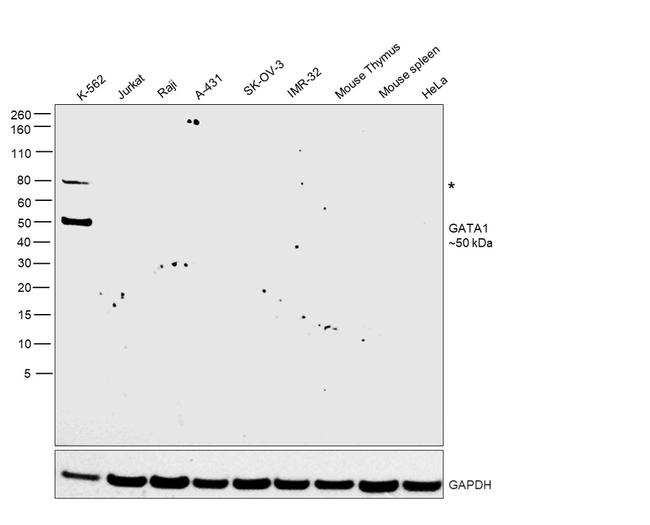 GATA1 Antibody in Western Blot (WB)