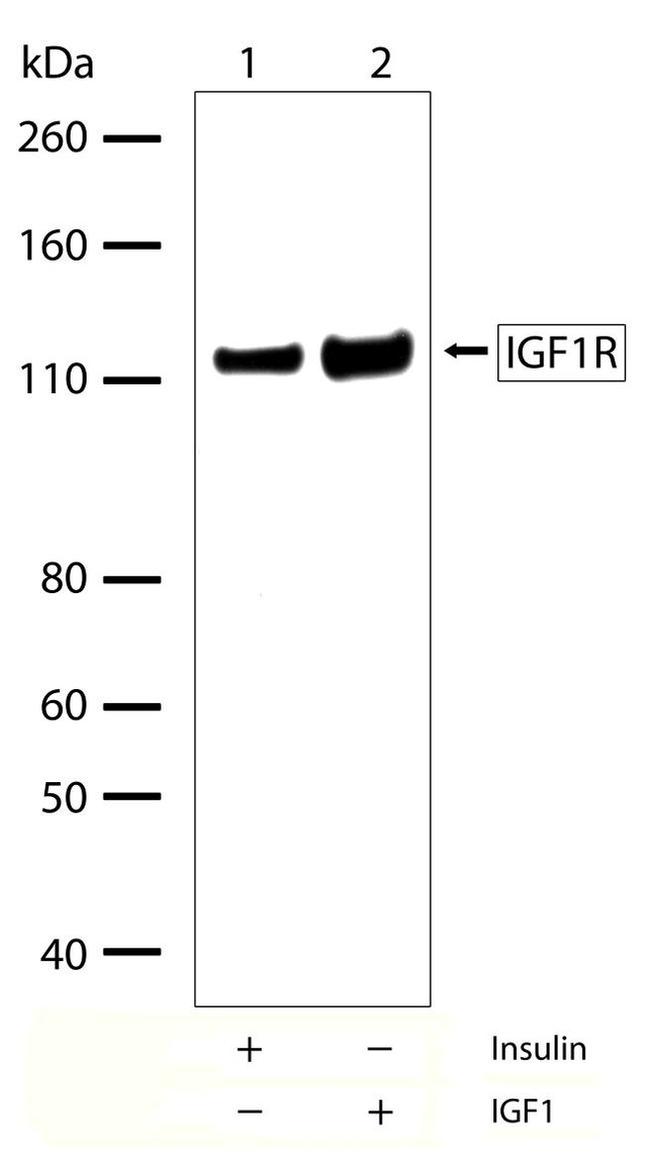 IGF1R beta Antibody in Western Blot (WB)