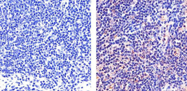 STAT5 alpha Antibody in Immunohistochemistry (Paraffin) (IHC (P))