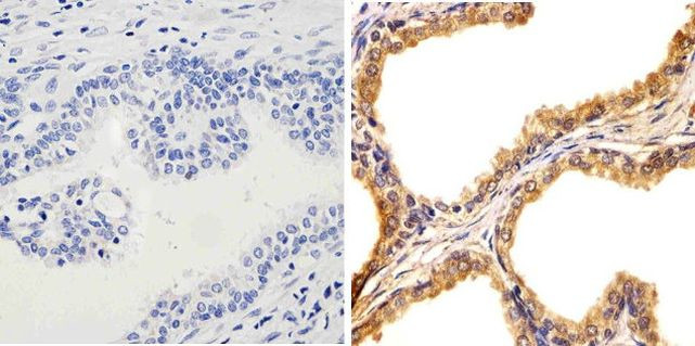 JNK1 Antibody in Immunohistochemistry (Paraffin) (IHC (P))