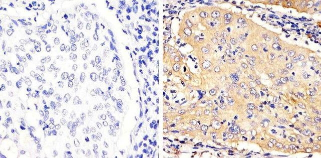 STAT3 Antibody in Immunohistochemistry (Paraffin) (IHC (P))