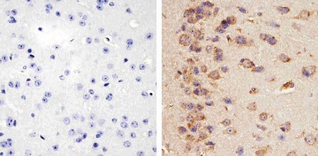 STAT3 Antibody in Immunohistochemistry (Paraffin) (IHC (P))