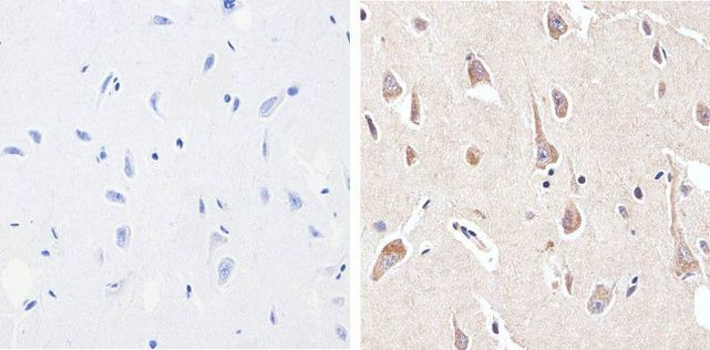 Phospho-PYK2 (Tyr402) Antibody in Immunohistochemistry (Paraffin) (IHC (P))