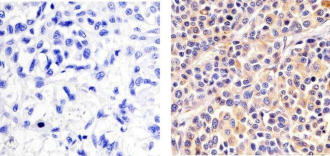 Phospho-p38 MAPK (Thr180, Tyr182) Antibody in Immunohistochemistry (Paraffin) (IHC (P))