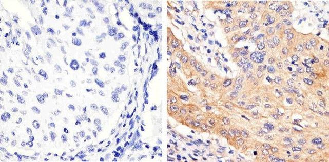 Phospho-STAT3 (Tyr705) Antibody in Immunohistochemistry (Paraffin) (IHC (P))