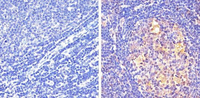 Phospho-STAT5 alpha (Tyr694) Antibody in Immunohistochemistry (Paraffin) (IHC (P))