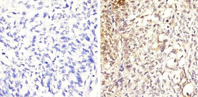 Phospho-STAT5 alpha (Tyr694) Antibody in Immunohistochemistry (Paraffin) (IHC (P))