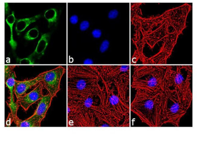 Phospho-INSR (Tyr1158) Antibody in Immunocytochemistry (ICC/IF)