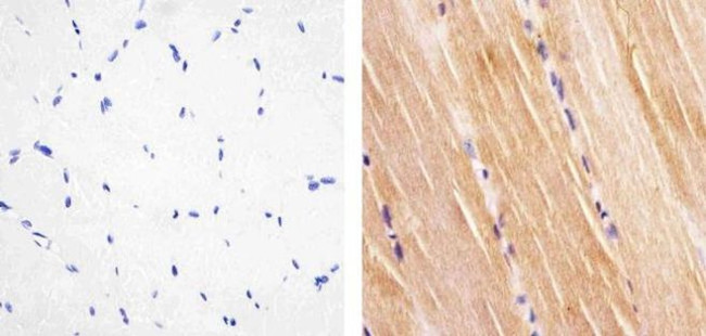 Phospho-INSR (Tyr1158) Antibody in Immunohistochemistry (Paraffin) (IHC (P))