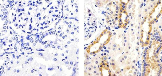 Phospho-AS160 (Thr642) Antibody in Immunohistochemistry (Paraffin) (IHC (P))