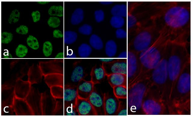 alpha Synuclein Antibody in Immunocytochemistry (ICC/IF)