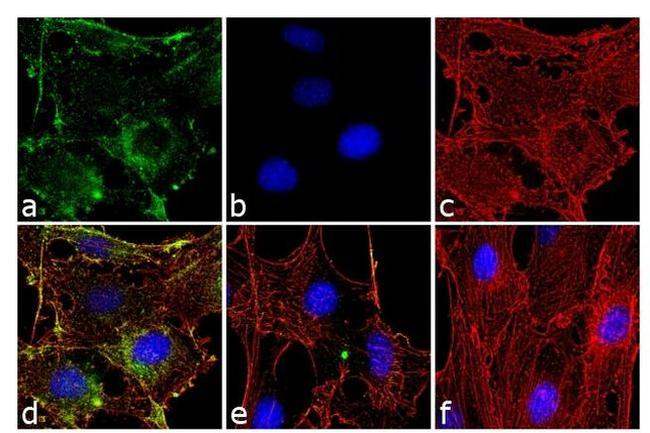 Phospho-AKT1 (Thr308) Antibody