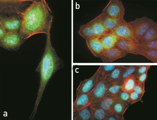 Phospho-AKT1 (Thr308) Antibody in Immunocytochemistry (ICC/IF)