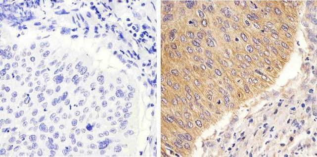 STAT2 Antibody in Immunohistochemistry (Paraffin) (IHC (P))