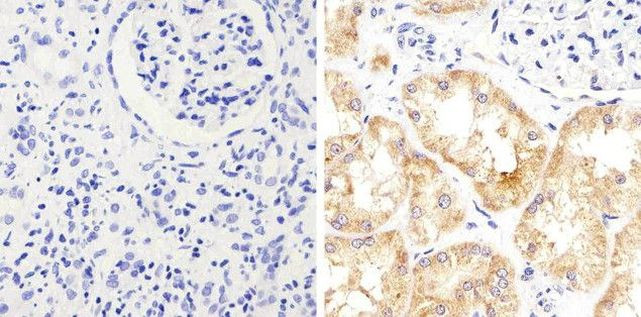 STAT2 Antibody in Immunohistochemistry (Paraffin) (IHC (P))