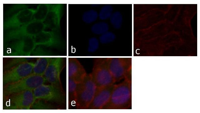 STAT2 Antibody in Immunocytochemistry (ICC/IF)