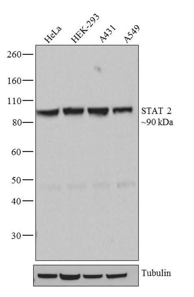 STAT2 Antibody in Western Blot (WB)