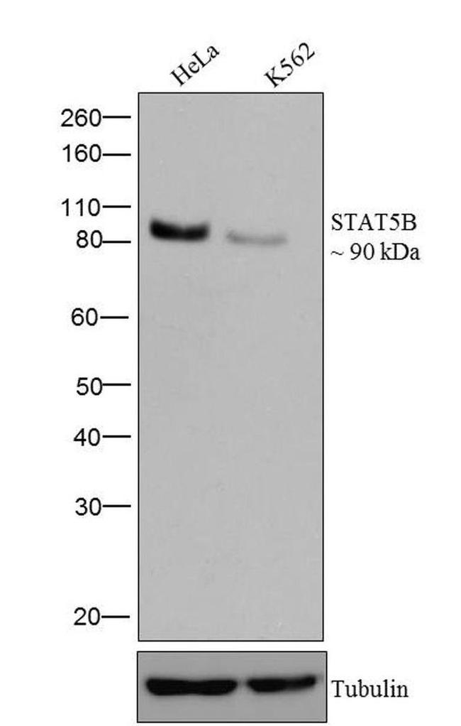 STAT5 beta Antibody in Western Blot (WB)