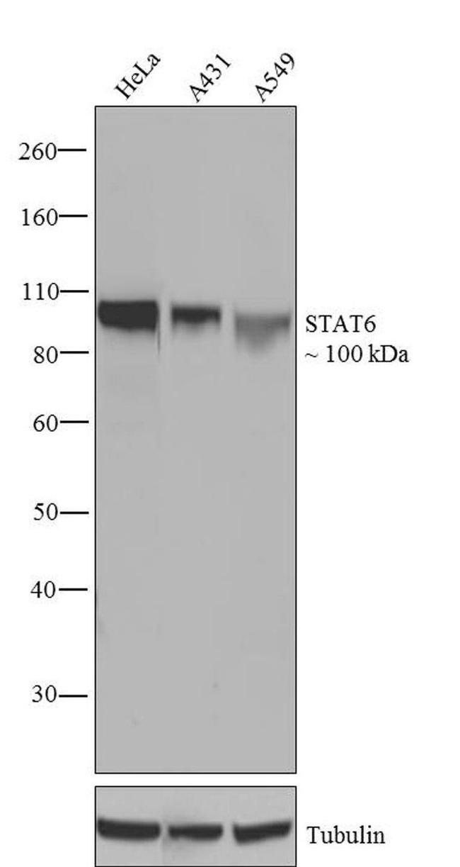 STAT6 Antibody in Western Blot (WB)